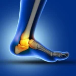 ankle pain