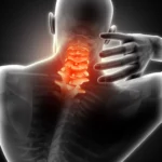 neck pain