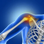 shoulder pain